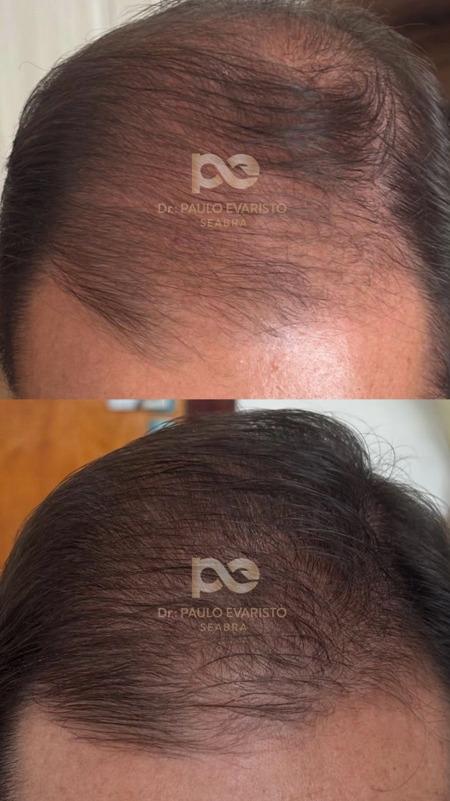 antes e depois 1