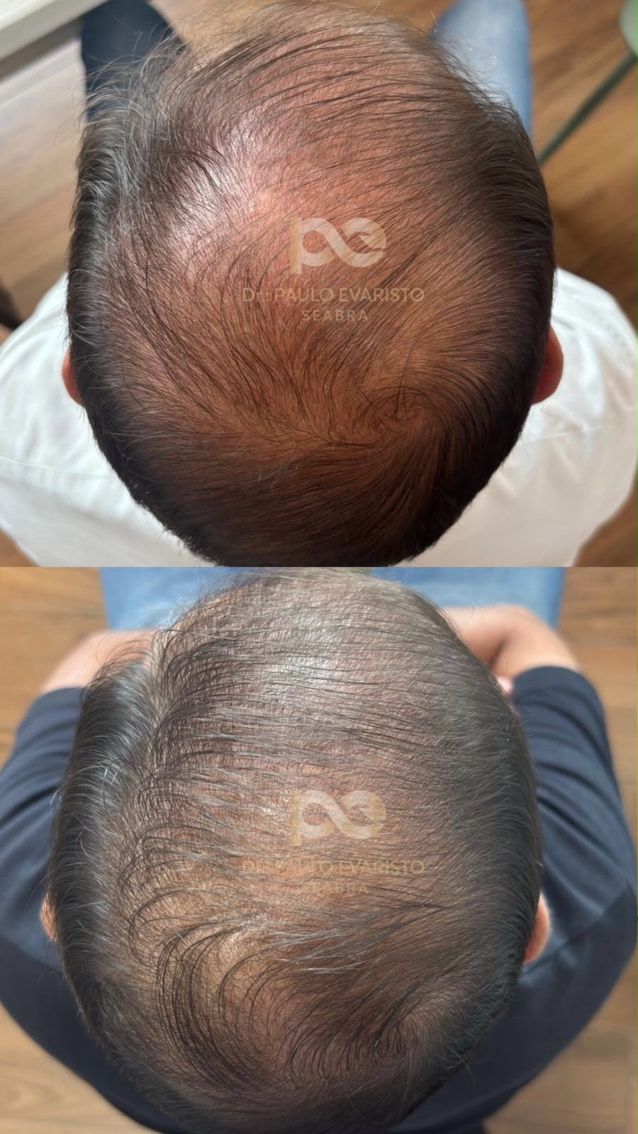 antes e depois 2