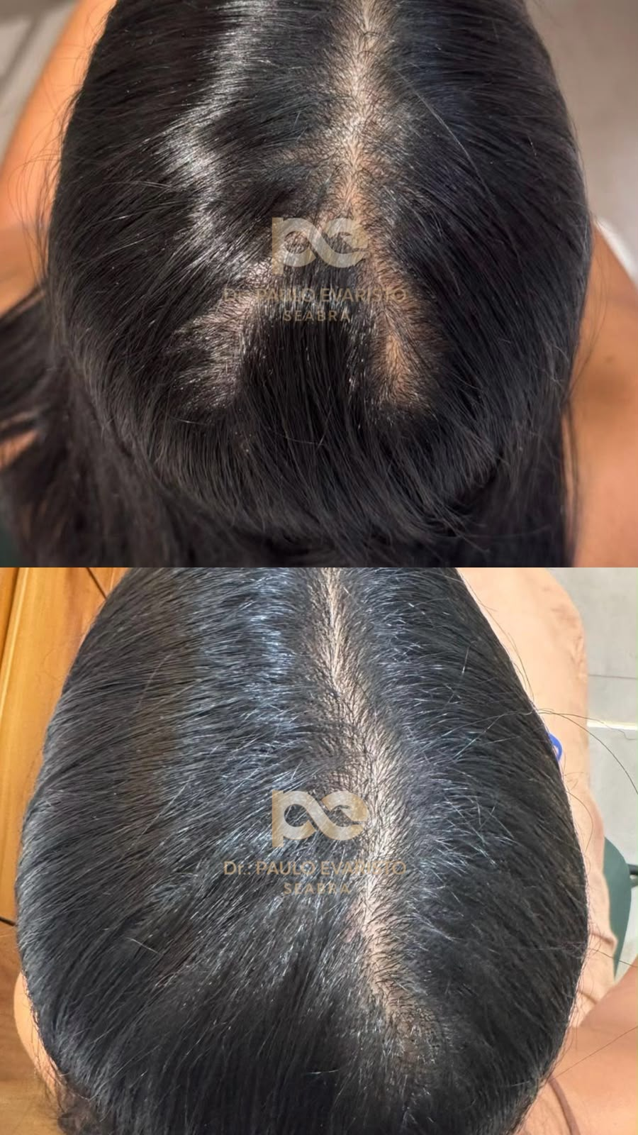 antes e depois 3