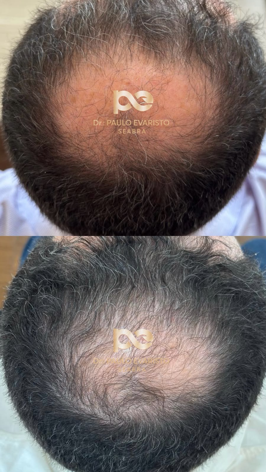 antes e depois 4