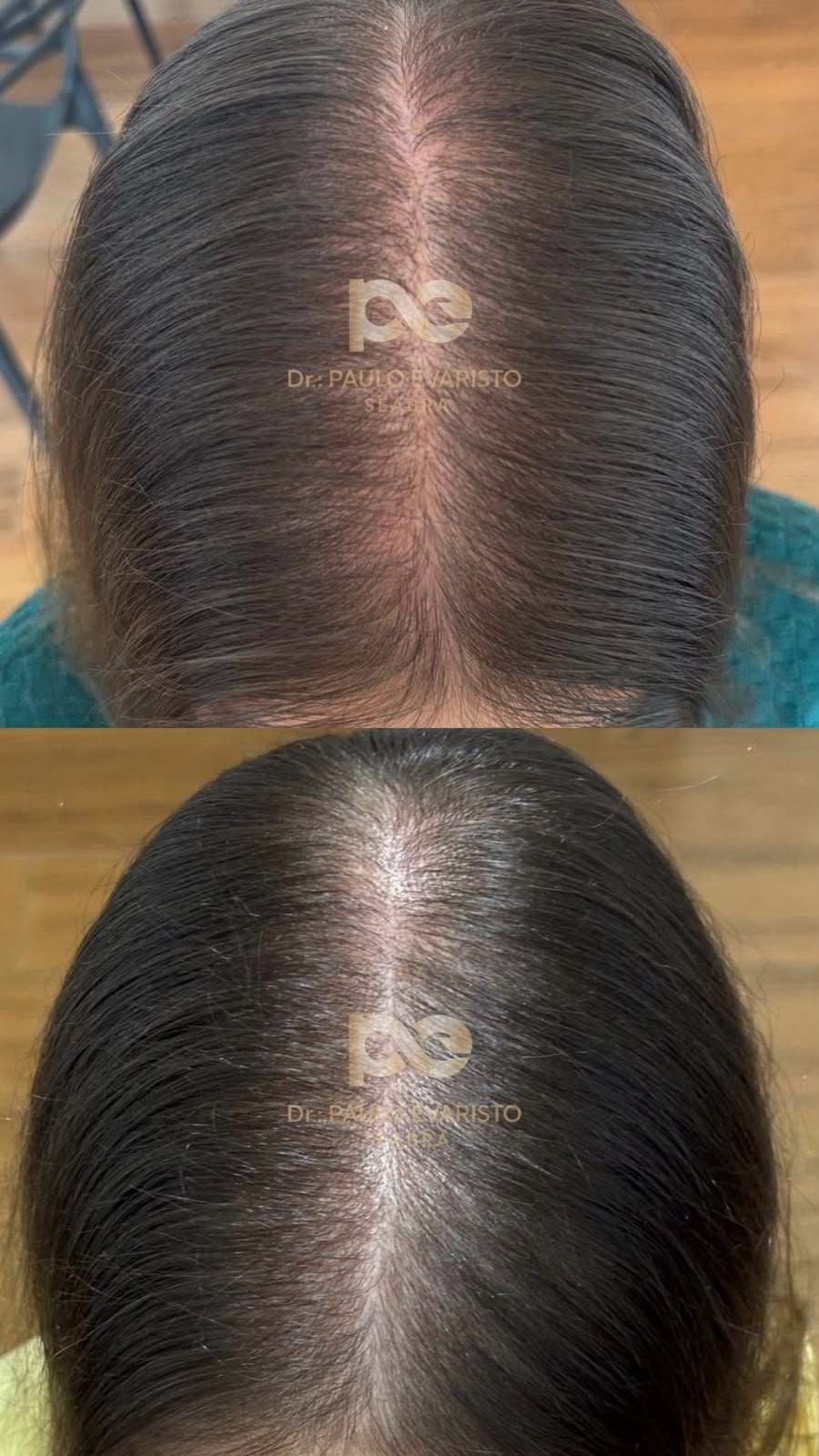 antes e depois 6